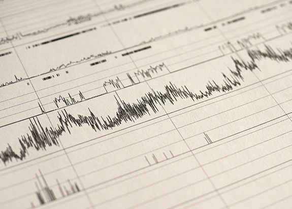 Sleep test data