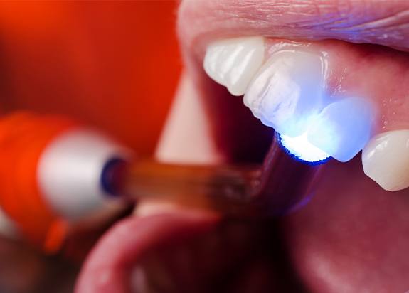 Patient receiving dental bonding treatment