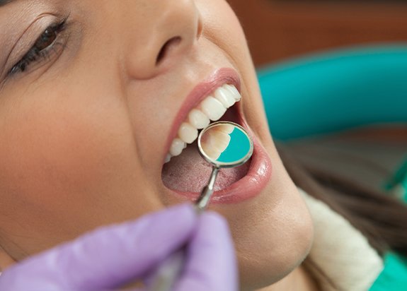 Dentist checking patient's tooth colored fillings