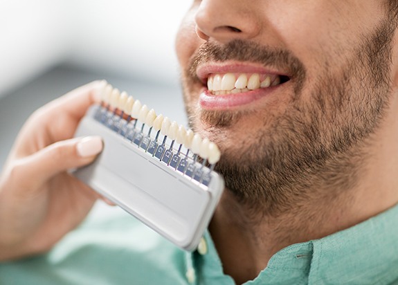 Man's smile compared with porcelain veneer shade chart