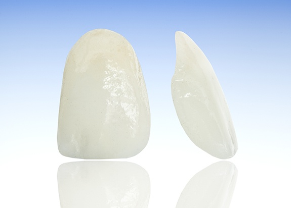 Two sample metal free dental restorations prior to placement