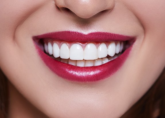 Woman's beautiful smile after gum recontouring treatment