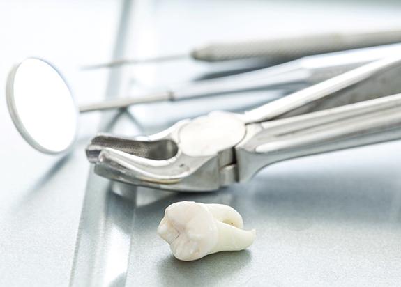 Forceps and dental mirror next to tooth after tooth extraction in Fresno, CA