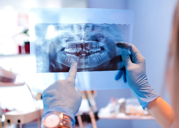 Dentist pointing to patient's X-ray