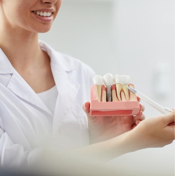 doctor showing patient an implant