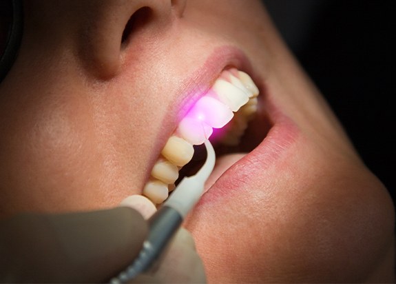 Patient receiving laser periodontal therapy