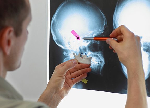 dentist showing a patient an X-ray of their jaw  