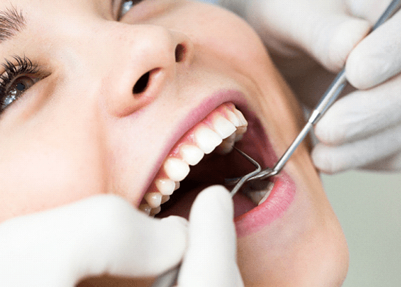 a patient getting tooth-colored fillings in Fresno