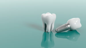 A natural tooth and an implant side-by-side