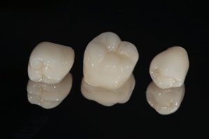 three same-day dental crowns in Fresno against black background