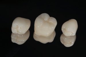 three same-day dental crowns in Fresno against black background 