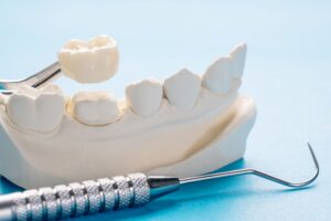 Dental instrument placing dental crown over model tooth