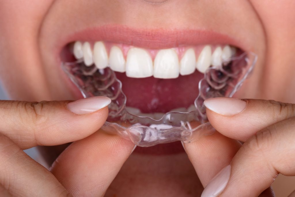 Patient smiling while placing Invisalign aligner in position