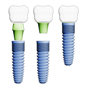 Image of dental implant parts