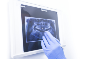 dentist viewing dental x-ray