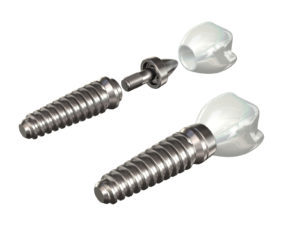 two dental implants